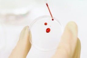 Learn how to Work with Bloodborne Pathogens