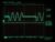 Arduino Based Real-Time Oscilloscope