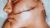 Dermaplaning – The Complete Guide