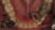 Learn Clinical Photography in Dentistry