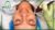 Microneedling/ Dermapen professional or at home treatment