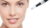 Microneedling treatment