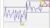 Quality Management – Statistical Process Control in Excel